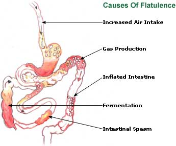 Excessive Flatulence Causes And Cures