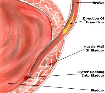 How do you treat bladder pain?